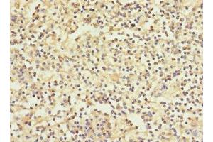 Immunohistochemistry of paraffin-embedded human spleen tissue using ABIN7166279 at dilution of 1:100 (WFDC11 抗体  (AA 26-87))