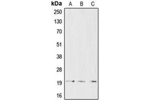 Western blot analysis of CD3d expression in CCRFCEM (A), Jurkat (B), HuT78 (C) whole cell lysates. (CD3D 抗体  (Center))