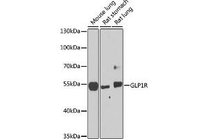 Western blot analysis of extracts of various cell lines, using GLP1R antibody (ABIN6131006, ABIN6141138, ABIN6141140 and ABIN6224643) at 1:1000 dilution. (GLP1R 抗体  (AA 22-116))