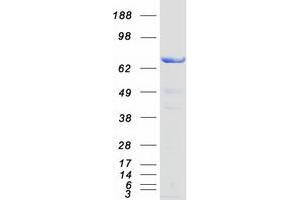 Validation with Western Blot