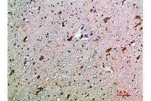 Immunohistochemical analysis of paraffin-embedded human-brain, antibody was diluted at 1:200 (KLRK1 抗体  (AA 167-216))