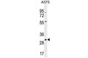 COPE Antibody (C-term) western blot analysis in A375 cell line lysates (35µg/lane). (COPE 抗体  (C-Term))