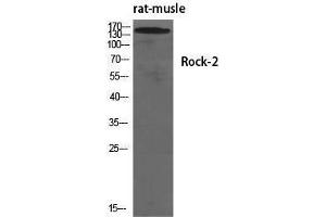 Western Blotting (WB) image for anti-rho-Associated, Coiled-Coil Containing Protein Kinase 2 (ROCK2) (Tyr466) antibody (ABIN3186830) (ROCK2 抗体  (Tyr466))