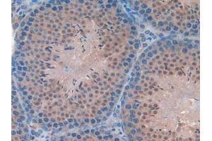 IHC-P analysis of Mouse Testis Tissue, with DAB staining. (FAM19A2 抗体  (AA 31-119))