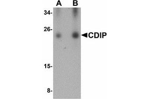 Image no. 1 for anti-LITAF-Like Protein (CDIP1) (Internal Region) antibody (ABIN478045) (CDIP1 抗体  (Internal Region))