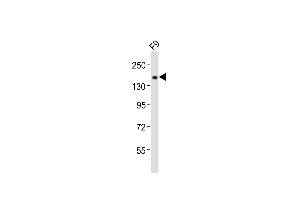 Anti-Tet1 Antibody (C-term)at 1:2000 dilution + F9 whole cell lysates Lysates/proteins at 20 μg per lane. (TET1 抗体  (C-Term))