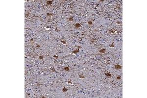 Immunohistochemical staining of human cerebral cortex with SYT13 polyclonal antibody  shows strong cytoplasmic positivity in neuronal cells at 1:50-1:200 dilution. (SYT13 抗体)