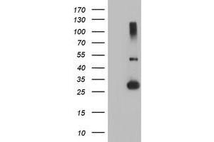 Western Blotting (WB) image for anti-Regulatory Factor X-Associated Ankyrin Containing Protein (RFXANK) antibody (ABIN1500680) (RFXANK 抗体)