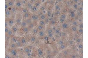 Detection of LEI in Rat Liver Tissue using Polyclonal Antibody to Leukocyte Elastase Inhibitor (LEI) (SERPINB1 抗体  (AA 17-332))