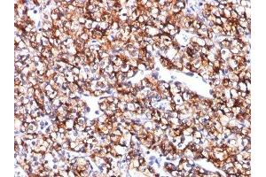 Image no. 1 for anti-Carbonic Anhydrase IX (CA9) antibody (ABIN6182201) (CA9 抗体)