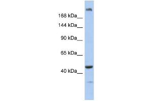 WB Suggested Anti-KIAA0284 Antibody Titration: 0. (KIAA0284 抗体  (N-Term))