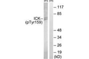 Western blot analysis of extracts from NIH-3T3 cells treated with starved 24h, using ICK (Phospho-Tyr159) Antibody. (ICK 抗体  (pTyr159))