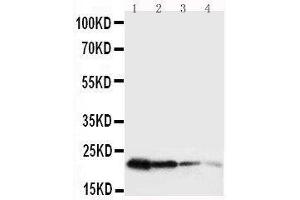 Anti-mouse Growth Hormone antibody, Western blotting Lane 1: Recombinant Mouse GH Protein 10ng Lane 2: Recombinant Mouse GH Protein 5ng Lane 3: Recombinant Mouse GH Protein 2 (Growth Hormone 1 抗体  (AA 27-216))
