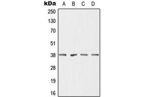 Western blot analysis of DHRS7 expression in MCF7 (A), HepG2 (B), mouse liver (C), rat liver (D) whole cell lysates. (DHRS7 抗体  (C-Term))