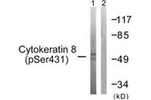 Western blot analysis of extracts from 293 cells treated with EGF 200ng/ml 30', using Keratin 8 (Phospho-Ser432) Antibody. (KRT8 抗体  (pSer432))