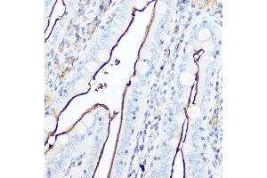 Immunohistochemistry of paraffin-embedded mouse intestin using CD13/ANPEP Rabbit pAb (ABIN6131185, ABIN6136911, ABIN6136912 and ABIN6221309) at dilution of 1:50 (40x lens).