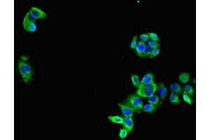 Immunofluorescent analysis of PC-3 cells using ABIN7158996 at dilution of 1:100 and Alexa Fluor 488-congugated AffiniPure Goat Anti-Rabbit IgG(H+L) (MARK3 抗体  (AA 368-667))