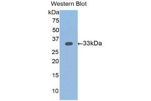 Western Blotting (WB) image for anti-Slit Homolog 1 (SLIT1) (AA 345-623) antibody (ABIN1176116) (SLIT1 抗体  (AA 345-623))