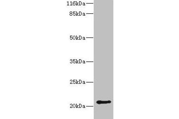 HDDC3 Antikörper  (AA 2-140)