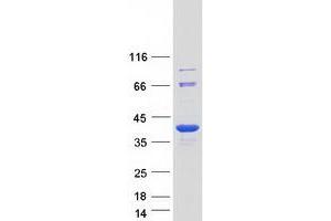 Western Blotting (WB) image for STIP1 Homology and U-Box Containing Protein 1 (STUB1) protein (Myc-DYKDDDDK Tag) (ABIN2732910)