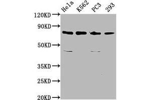 Western Blot Positive WB detected in: Hela whole cell lysate, K562 whole cell lysate, PC-3 whole cell lysate, 293 whole cell lysate All lanes: INTS13 antibody at 3. (Integrator Complex Subunit 13 (INTS13) (AA 573-706) 抗体)