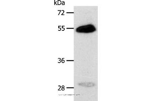 Western blot analysis of Human liver cancer tissue, using CA14 Polyclonal Antibody at dilution of 1:400 (CA14 抗体)