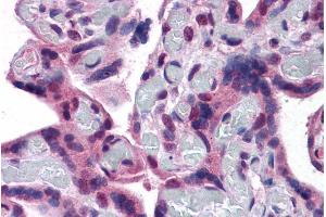 Immunohistochemistry (IHC) image for anti-Transient Receptor Potential Cation Channel, Subfamily C, Member 4 (TRPC4) (Internal Region) antibody (ABIN570934)