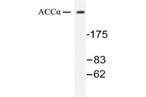 Image no. 1 for anti-Acetyl-CoA Carboxylase alpha (ACACA) antibody (ABIN271866) (Acetyl-CoA Carboxylase alpha 抗体)