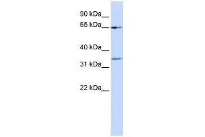 WB Suggested Anti-ZNF157 Antibody Titration:  0. (ZNF157 抗体  (N-Term))