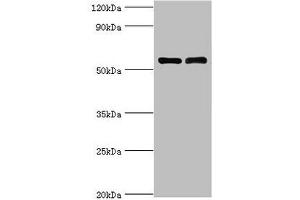 Western blot All lanes: IL7R antibody at 4 μg/mL Lane 1: K562 whole cell lysate Lane 2: Jurkat whole cell lysate Secondary Goat polyclonal to rabbit IgG at 1/10000 dilution Predicted band size: 52, 35, 30, 29 kDa Observed band size: 52 kDa (IL7R 抗体  (AA 21-239))