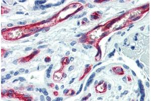 Human Placenta (formalin-fixed, paraffin-embedded) stained with CD34 antibody ABIN461990 at 1:50 followed by biotinylated anti-mouse IgG secondary antibody ABIN481714, alkaline phosphatase-streptavidin and chromogen. (CD34 抗体  (FITC))
