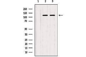 Western blot analysis of extracts from various samples, using IP3KB Antibody. (ITPKB 抗体  (Internal Region))