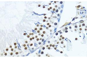 Immunohistochemistry of paraffin-embedded Rat testis using TriMethyl-Histone H3-K79 Polyclonal Antibody at dilution of 1:200 (40x lens).