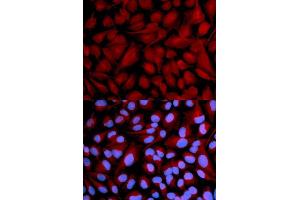 Immunofluorescence analysis of U2OS cell using CASK antibody. (CASK 抗体  (AA 1-300))