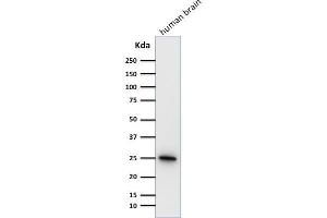 Western Blotting (WB) image for anti-Ubiquitin Carboxyl-terminal Esterase L1 (Ubiquitin Thiolesterase) (UCHL1) antibody (ABIN6940850)