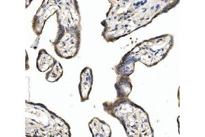 IHC analysis of DLL1 using anti-DLL1 antibody (ABIN7600324). (DLL1 抗体  (AA 18-239))