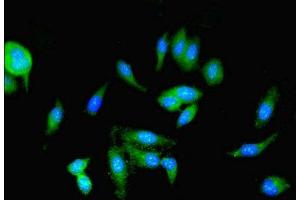 Immunofluorescent analysis of Hela cells using ABIN7166912 at dilution of 1:100 and Alexa Fluor 488-congugated AffiniPure Goat Anti-Rabbit IgG(H+L) (PKM 抗体  (AA 2-192))