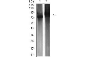 Western blot analysis using IGHM mouse mAb against Raji (1) and Ramos (2) cell lysate. (IGHM 抗体  (AA 310-452))