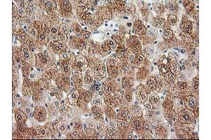 Immunohistochemical staining of paraffin-embedded Human liver tissue using anti-HDHD2 mouse monoclonal antibody. (HDHD2 抗体)