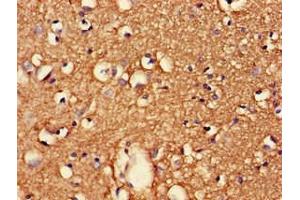 Immunohistochemistry of paraffin-embedded human brain tissue using ABIN7147230 at dilution of 1:100