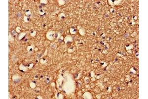 Immunohistochemistry of paraffin-embedded human brain tissue using ABIN7147230 at dilution of 1:100 (CDK5RAP2 抗体  (Regulatory Subunit))