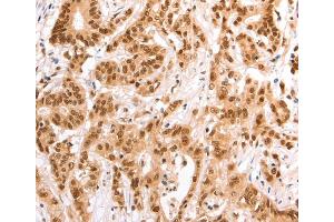 Immunohistochemistry (IHC) image for anti-Tax1 (Human T-Cell Leukemia Virus Type I) Binding Protein 1 (TAX1BP1) antibody (ABIN2422292) (TAX1BP1 抗体)