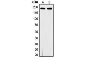 Western blot analysis of VEGFR1 (pY1213) expression in A10 (A), MDAMB231 (B) whole cell lysates. (FLT1 抗体  (C-Term, pTyr1213))