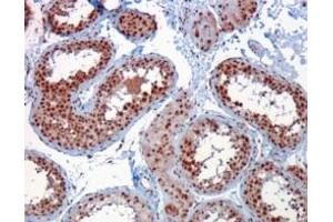 Immunohistochemistry (IHC) image for anti-Rac GTPase Activating Protein 1 (RACGAP1) (C-Term) antibody (ABIN184690)