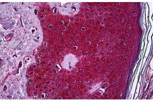 Human Skin: Formalin-Fixed, Paraffin-Embedded (FFPE) (TNF alpha 抗体  (AA 1-234))