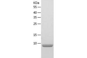 Western Blotting (WB) image for Chemokine (C-X-C Motif) Ligand 6 (CXCL6) (AA 43-114) protein (His-IF2DI Tag) (ABIN7123194)