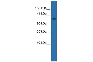 WB Suggested Anti-CDKL5 Antibody Titration: 0. (CDKL5 抗体  (C-Term))