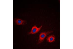 Immunofluorescent analysis of Apolipoprotein L2 staining in HepG2 cells. (Apolipoprotein L 2 抗体  (Center))