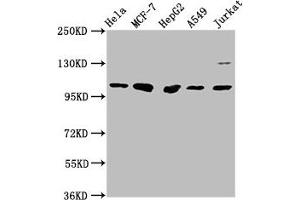 Western Blot Positive WB detected in: Hela whole cell lysate, MCF-7 whole cell lysate, HepG2 whole cell lysate, A549 whole cell lysate, Jurkat whole cell lysate All lanes: GANC antibody at 1:1000 Secondary Goat polyclonal to rabbit IgG at 1/50000 dilution Predicted band size: 105 kDa Observed band size: 105 kDa