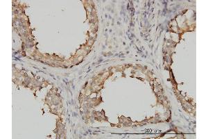 Immunostaining (ISt) image for anti-Tubulin, alpha 4a (TUBA4A) (AA 1-448) antibody (ABIN563289)